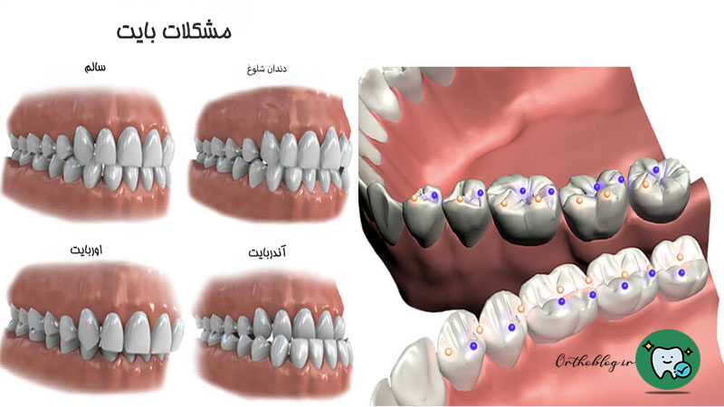 مشکلات بایت