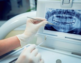 ارتودنسی دندان چند مرحله دارد-1