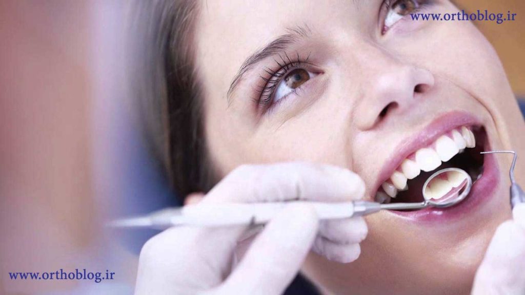 معاینه ارتودنسی دندان