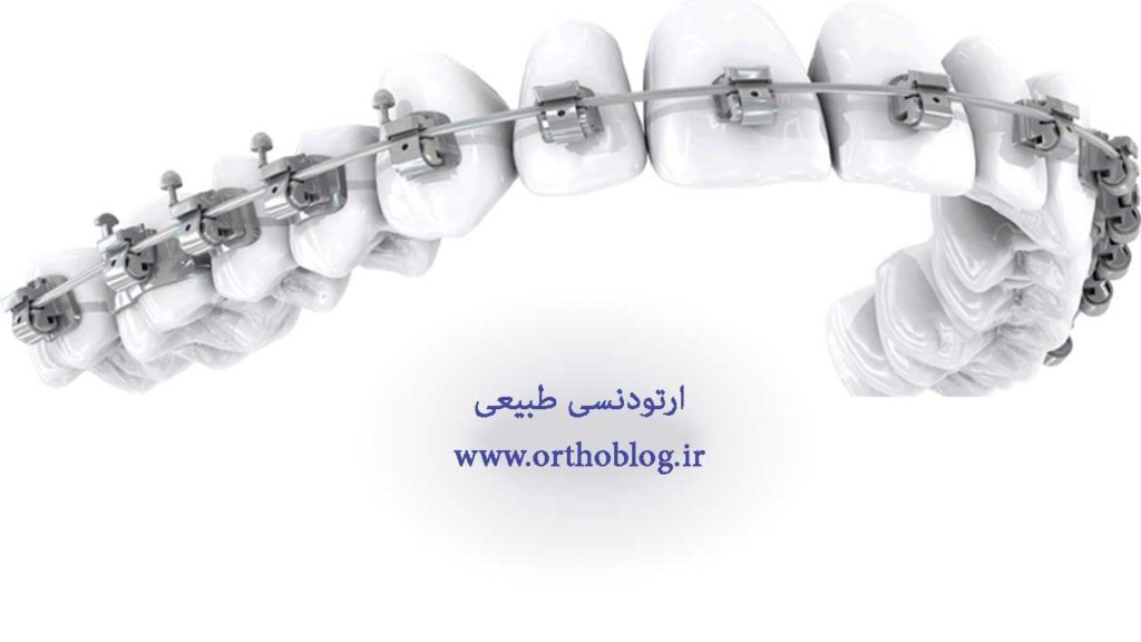 ارتودنسی طبیعی