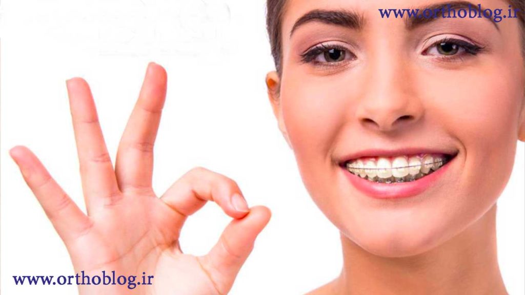 رضایت بعد از انجام ارتودنسی