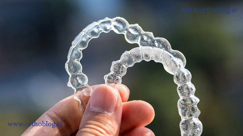 invisalign چیست