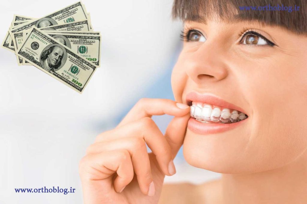 هزینه ارتودنسی دندان 