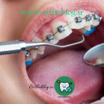 ارتودنسی زودبازده