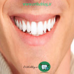 ارتودنسی فوری