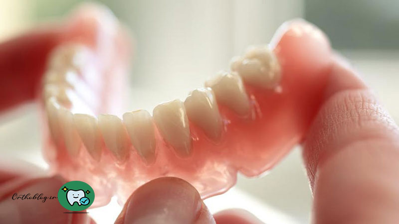 عوامل موثر بر هزینه دندان مصنوعی

