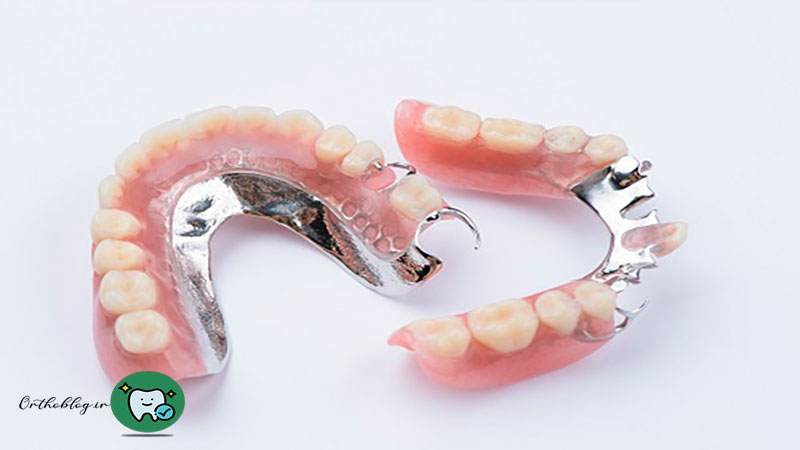 قیمت دندان مصنوعی بیمه آتیه سازان حافظ