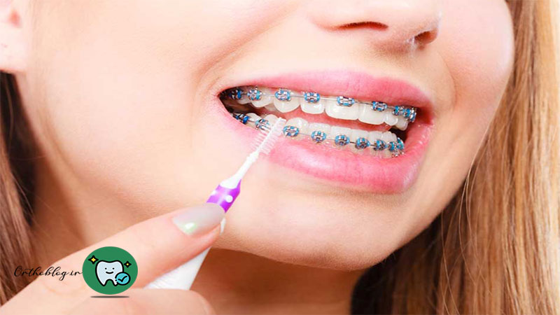 بهبود بهداشت دهان و دندان