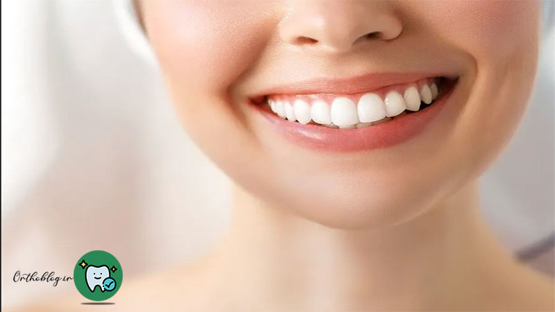 بهبود زیبایی دندان های جلو